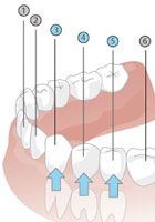 Reihenfolge in der die bleibenden Zähne wachsen